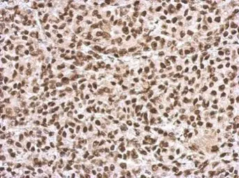 Anti-SFPQ antibody used in IHC (Paraffin sections) (IHC-P). GTX112116