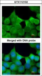 Anti-EXOC7 antibody [N1C1] used in Immunocytochemistry/ Immunofluorescence (ICC/IF). GTX112132