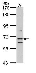 Anti-EXOC7 antibody [N1C1] used in Western Blot (WB). GTX112132