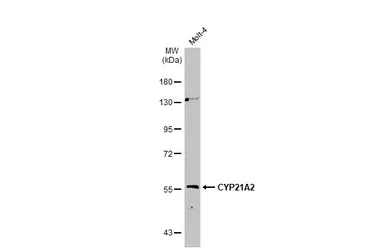 Anti-CYP21A2 antibody [N2C3] used in Western Blot (WB). GTX112135