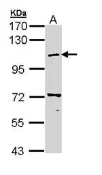 Anti-COPB antibody [N1N3] used in Western Blot (WB). GTX112140