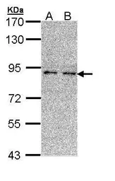 Anti-LONRF3 antibody [N2C2], Internal used in Western Blot (WB). GTX112150