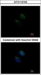 Anti-MGAT3 antibody [N3C3] used in Immunocytochemistry/ Immunofluorescence (ICC/IF). GTX112153