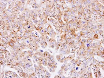 Anti-MGAT3 antibody [N3C3] used in IHC (Paraffin sections) (IHC-P). GTX112153