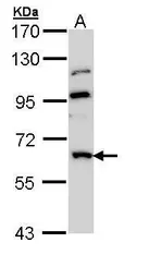Anti-MGAT3 antibody [N3C3] used in Western Blot (WB). GTX112153
