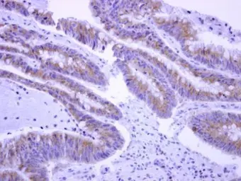 Anti-EPS8L2 antibody used in IHC (Paraffin sections) (IHC-P). GTX112158