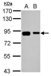 Anti-EPS8L2 antibody used in Western Blot (WB). GTX112158