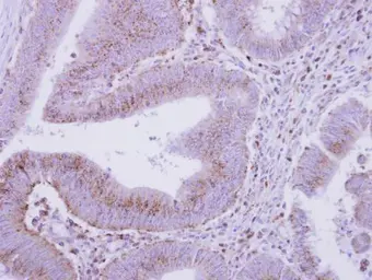 Anti-COPB antibody used in IHC (Paraffin sections) (IHC-P). GTX112164