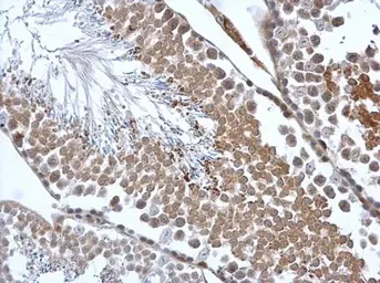 Anti-Calreticulin 3 antibody used in IHC (Paraffin sections) (IHC-P). GTX112177