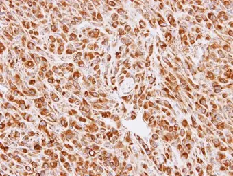 Anti-Calreticulin 3 antibody used in IHC (Paraffin sections) (IHC-P). GTX112177