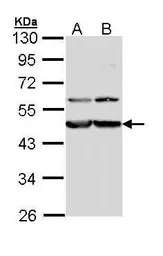 Anti-Calreticulin 3 antibody used in Western Blot (WB). GTX112177