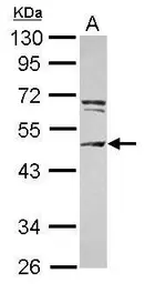 Anti-CEP55 antibody [N2C3] used in Western Blot (WB). GTX112190