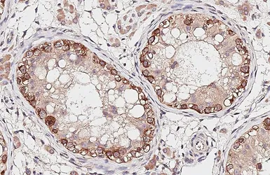 Anti-G3BP1 antibody used in IHC (Paraffin sections) (IHC-P). GTX112191