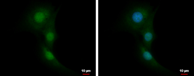 Anti-RNF14 antibody [N1C1] used in Immunocytochemistry/ Immunofluorescence (ICC/IF). GTX112193