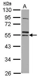 Anti-RNF14 antibody [N1C1] used in Western Blot (WB). GTX112193