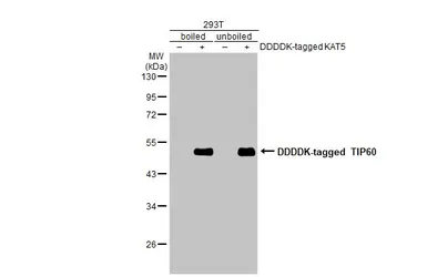 Anti-TIP60 antibody used in Western Blot (WB). GTX112197