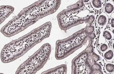 Anti-TIP60 antibody used in IHC (Paraffin sections) (IHC-P). GTX112197