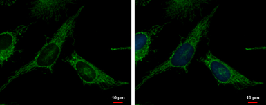 Anti-TXNRD2 antibody used in Immunocytochemistry/ Immunofluorescence (ICC/IF). GTX112199