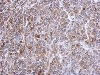 Anti-TXNRD2 antibody used in IHC (Paraffin sections) (IHC-P). GTX112199
