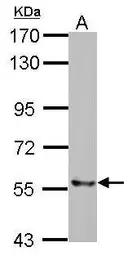 Anti-TXNRD2 antibody used in Western Blot (WB). GTX112199