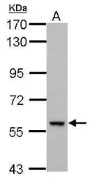 Anti-DEAF1 antibody used in Western Blot (WB). GTX112207