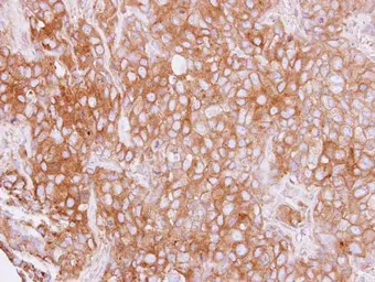 Anti-Cytokeratin 4 antibody used in IHC (Paraffin sections) (IHC-P). GTX112211