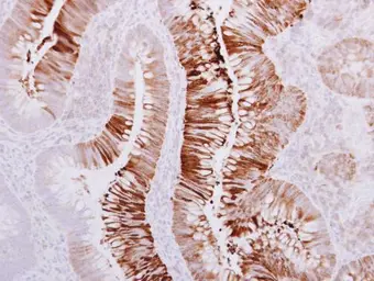 Anti-SAH3 antibody [N3C3] used in IHC (Paraffin sections) (IHC-P). GTX112212