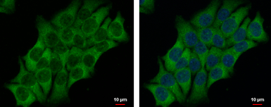 Anti-SAH3 antibody [N3C3] used in Immunocytochemistry/ Immunofluorescence (ICC/IF). GTX112212