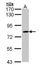 Anti-SAH3 antibody [N3C3] used in Western Blot (WB). GTX112212