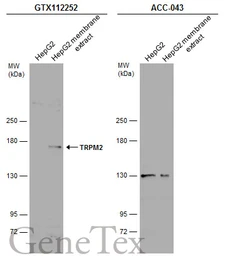 Anti-TRPM2 antibody [N1N2-2], N-term used in Western Blot (WB). GTX112252