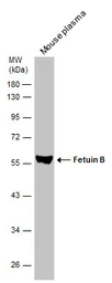 Anti-Fetuin B antibody used in Western Blot (WB). GTX112260