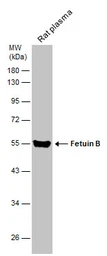 Anti-Fetuin B antibody used in Western Blot (WB). GTX112260