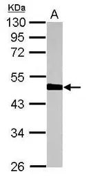 Anti-HERPUD1 antibody used in Western Blot (WB). GTX112261