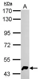 Anti-HERPUD1 antibody used in Western Blot (WB). GTX112261