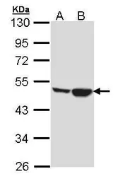 Anti-Creatine kinase MT antibody [N1C2] used in Western Blot (WB). GTX112264
