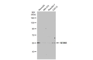 Anti-SESN3 antibody used in Western Blot (WB). GTX112277