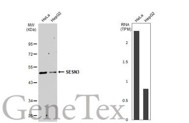 Anti-SESN3 antibody used in Western Blot (WB). GTX112277