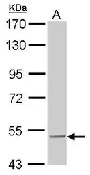 Anti-SESN3 antibody used in Western Blot (WB). GTX112277