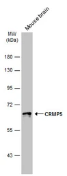 Anti-CRMP5 antibody [N1C1] used in Western Blot (WB). GTX112287