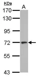 Anti-L3MBTL4 antibody [N2C2], Internal used in Western Blot (WB). GTX112290