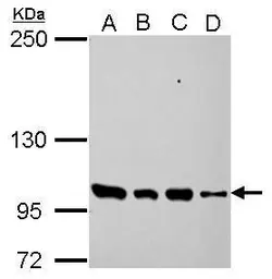 Anti-PDE3A antibody [N3C1], Internal used in Western Blot (WB). GTX112305