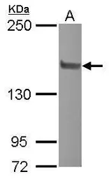 Anti-NCOA2 antibody [C2C3], C-term used in Western Blot (WB). GTX112307