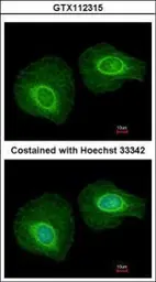 Anti-Cytokeratin 34 antibody [N1C2] used in Immunocytochemistry/ Immunofluorescence (ICC/IF). GTX112315