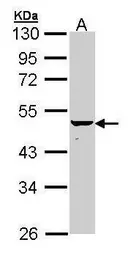 Anti-Cytokeratin 34 antibody [N1C2] used in Western Blot (WB). GTX112315