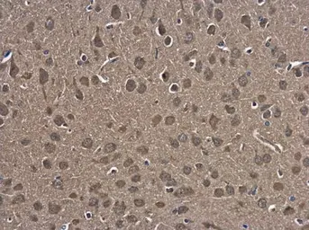 Anti-HSPA4 antibody [N1N3] used in IHC (Paraffin sections) (IHC-P). GTX112329