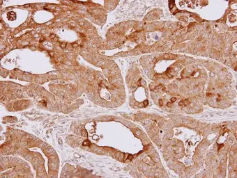 Anti-HSPA4 antibody [N1N3] used in IHC (Paraffin sections) (IHC-P). GTX112329