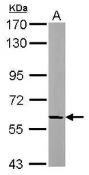 Anti-beta Adducin antibody [N1C1] used in Western Blot (WB). GTX112338