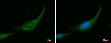 Anti-MYPT1 antibody used in Immunocytochemistry/ Immunofluorescence (ICC/IF). GTX112344