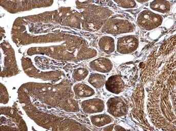 Anti-HMGCS1 antibody used in IHC (Paraffin sections) (IHC-P). GTX112346