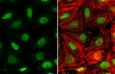 Anti-NAB1 antibody used in Immunocytochemistry/ Immunofluorescence (ICC/IF). GTX112354